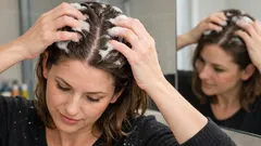 Ako často umývať vlasy, aby sa nemastili a pokožka hlavy nesvrbela